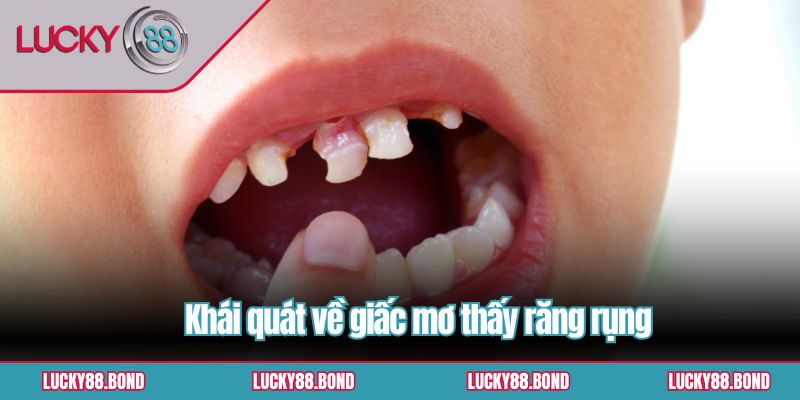 Khái quát về giấc mơ thấy răng rụng